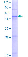 GLIPR1L2 Protein - 12.5% SDS-PAGE of human GLIPR1L2 stained with Coomassie Blue