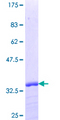 GLIPR2 Protein - 12.5% SDS-PAGE Stained with Coomassie Blue.