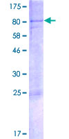 GLIS2 Protein - 12.5% SDS-PAGE of human GLIS2 stained with Coomassie Blue