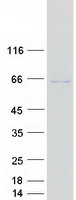 GLMN Protein - Purified recombinant protein GLMN was analyzed by SDS-PAGE gel and Coomassie Blue Staining