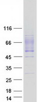 GLMP / C1orf85 Protein - Purified recombinant protein GLMP was analyzed by SDS-PAGE gel and Coomassie Blue Staining