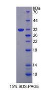 GLNRS / QARS Protein - Recombinant Glutaminyl tRNA Synthetase (QARS) by SDS-PAGE