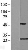 GLO1 / Glyoxalase I Protein - Western validation with an anti-DDK antibody * L: Control HEK293 lysate R: Over-expression lysate