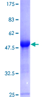 GLO1 / Glyoxalase I Protein - 12.5% SDS-PAGE of human GLO1 stained with Coomassie Blue