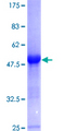 GLO1 / Glyoxalase I Protein - 12.5% SDS-PAGE of human GLO1 stained with Coomassie Blue