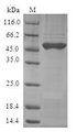 GLO1 / Glyoxalase I Protein - (Tris-Glycine gel) Discontinuous SDS-PAGE (reduced) with 5% enrichment gel and 15% separation gel.