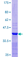 GLO1 / Glyoxalase I Protein - 12.5% SDS-PAGE Stained with Coomassie Blue.