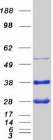 GLO1 / Glyoxalase I Protein - Purified recombinant protein GLO1 was analyzed by SDS-PAGE gel and Coomassie Blue Staining