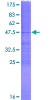 GLOD2 / MCEE Protein - 12.5% SDS-PAGE of human MCEE stained with Coomassie Blue
