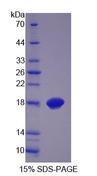 GLOD2 / MCEE Protein - Recombinant Methylmalonyl Coenzyme A Epimerase (MCEE) by SDS-PAGE