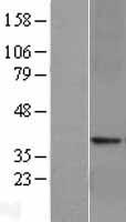 GLP1R / GLP-1 Receptor Protein - Western validation with an anti-DDK antibody * L: Control HEK293 lysate R: Over-expression lysate