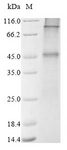 GLP1R / GLP-1 Receptor Protein - (Tris-Glycine gel) Discontinuous SDS-PAGE (reduced) with 5% enrichment gel and 15% separation gel.