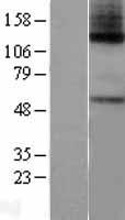 GLP2R Protein - Western validation with an anti-DDK antibody * L: Control HEK293 lysate R: Over-expression lysate