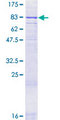 GLP2R Protein - 12.5% SDS-PAGE of human GLP2R stained with Coomassie Blue
