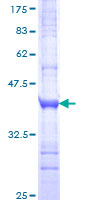 GLP2R Protein - 12.5% SDS-PAGE Stained with Coomassie Blue.