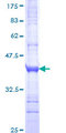 GLP2R Protein - 12.5% SDS-PAGE Stained with Coomassie Blue.
