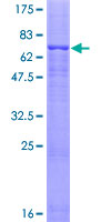 GLRA1/Glycine Receptor Alpha 1 Protein - 12.5% SDS-PAGE of human GLRA1 stained with Coomassie Blue
