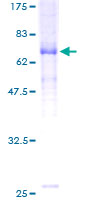 GLRA2 Protein - 12.5% SDS-PAGE of human GLRA2 stained with Coomassie Blue