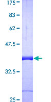 GLRX / Glutaredoxin Protein - 12.5% SDS-PAGE of human GLRX stained with Coomassie Blue