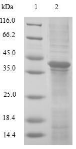 GLRX2 / Glutaredoxin 2 Protein - (Tris-Glycine gel) Discontinuous SDS-PAGE (reduced) with 5% enrichment gel and 15% separation gel.