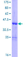 GLRX5 / Glutaredoxin 5 Protein - 12.5% SDS-PAGE of human GLRX5 stained with Coomassie Blue