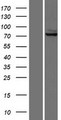 GLS / Glutaminase Protein - Western validation with an anti-DDK antibody * L: Control HEK293 lysate R: Over-expression lysate