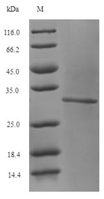 GLS / Glutaminase Protein - (Tris-Glycine gel) Discontinuous SDS-PAGE (reduced) with 5% enrichment gel and 15% separation gel.