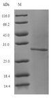 GLS / Glutaminase Protein - (Tris-Glycine gel) Discontinuous SDS-PAGE (reduced) with 5% enrichment gel and 15% separation gel.