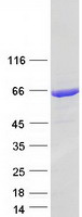 GLS / Glutaminase Protein - Purified recombinant protein GLS was analyzed by SDS-PAGE gel and Coomassie Blue Staining