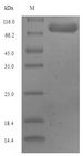 GLS2 / Glutaminase 2 Protein - (Tris-Glycine gel) Discontinuous SDS-PAGE (reduced) with 5% enrichment gel and 15% separation gel.