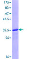 GLS2 / Glutaminase 2 Protein - 12.5% SDS-PAGE Stained with Coomassie Blue.