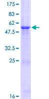 GLT1D1 Protein - 12.5% SDS-PAGE of human GLT1D1 stained with Coomassie Blue