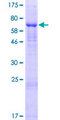 GLT8D2 Protein - 12.5% SDS-PAGE of human GLT8D2 stained with Coomassie Blue