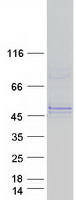 GLT8D2 Protein - Purified recombinant protein GLT8D2 was analyzed by SDS-PAGE gel and Coomassie Blue Staining