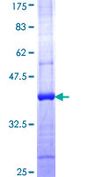 GLTP Protein - 12.5% SDS-PAGE Stained with Coomassie Blue.