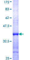 GLTSCR2 Protein - 12.5% SDS-PAGE Stained with Coomassie Blue.