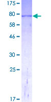 GLUD2 Protein - 12.5% SDS-PAGE of human GLUD2 stained with Coomassie Blue