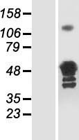 GLUL / Glutamine Synthetase Protein - Western validation with an anti-DDK antibody * L: Control HEK293 lysate R: Over-expression lysate
