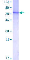 GLUL / Glutamine Synthetase Protein - 12.5% SDS-PAGE of human GLUL stained with Coomassie Blue
