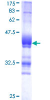 GLUL / Glutamine Synthetase Protein - 12.5% SDS-PAGE Stained with Coomassie Blue.