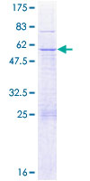 GLUP / PACRG Protein - 12.5% SDS-PAGE of human PACRG stained with Coomassie Blue