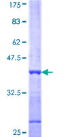 GLUP / PACRG Protein - 12.5% SDS-PAGE Stained with Coomassie Blue.