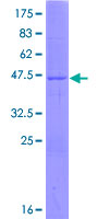 GLYAT Protein - 12.5% SDS-PAGE of human GLYAT stained with Coomassie Blue
