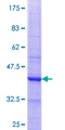 GLYAT Protein - 12.5% SDS-PAGE Stained with Coomassie Blue.