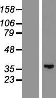 GLYATL2 Protein - Western validation with an anti-DDK antibody * L: Control HEK293 lysate R: Over-expression lysate