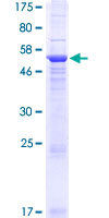 GLYATL2 Protein - 12.5% SDS-PAGE of human GLYATL2 stained with Coomassie Blue