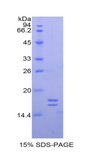 Glycocalicin Protein - Recombinant Glycocalicin By SDS-PAGE