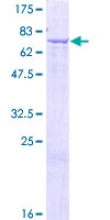 GLYCTK / Glycerate Kinase Protein - 12.5% SDS-PAGE of human GLYCTK stained with Coomassie Blue