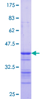 GLYCTK / Glycerate Kinase Protein - 12.5% SDS-PAGE Stained with Coomassie Blue.