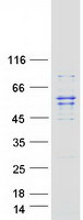 GLYCTK / Glycerate Kinase Protein - Purified recombinant protein GLYCTK was analyzed by SDS-PAGE gel and Coomassie Blue Staining